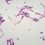 Public Health Image Library (PHIL), Center for Disease Control and Prevention (CDC), U.S.A.